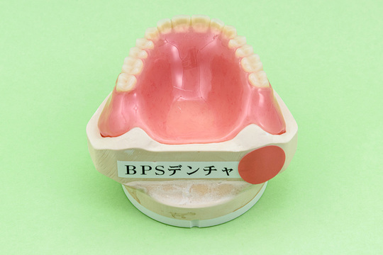 入れ歯治療の種類・料金 - 笹木歯科クリニック（いわき市）